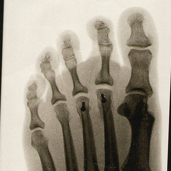 Extremity Radiology Review